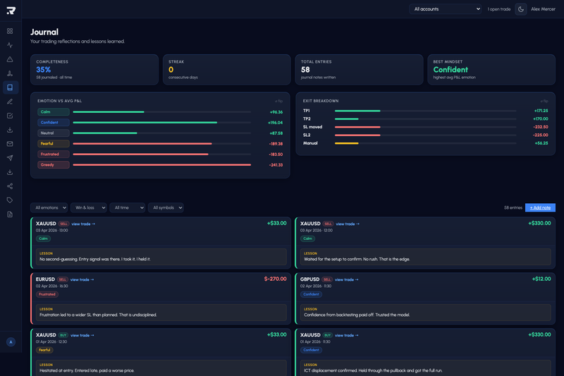 Trade Journal